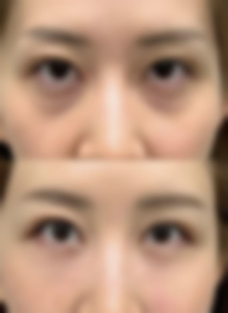 六、Toxnfill医院弘大新村店地址及交通