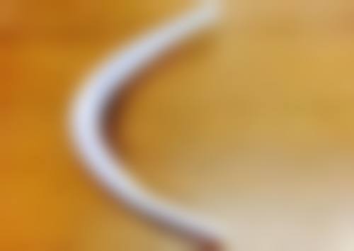 三、下颌角整形手术的美学设计原则