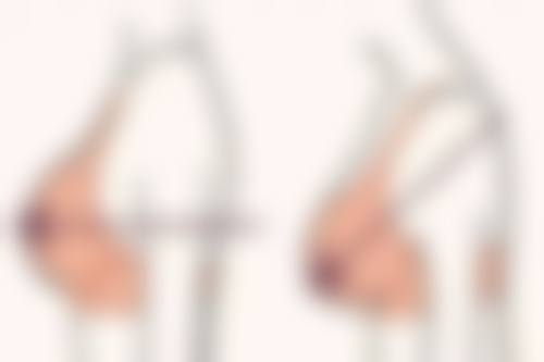 二、镇江华俪医疗美容门诊部怎么样？