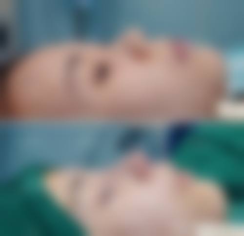 六、石家庄朝刚整形医疗美容医院价格表