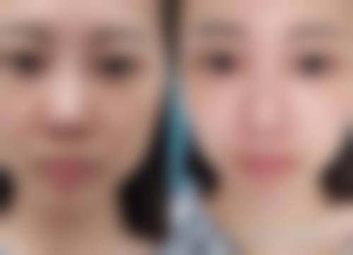 六、莱芜时光整形医院价格表