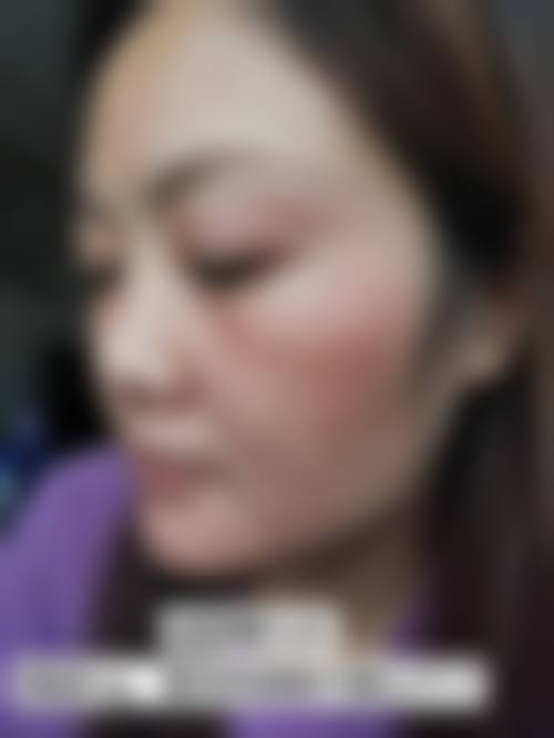 六、Lucia Clinic 京都乌丸价格表