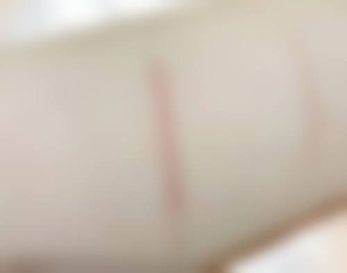 二、巴中系美整形医院怎么样？