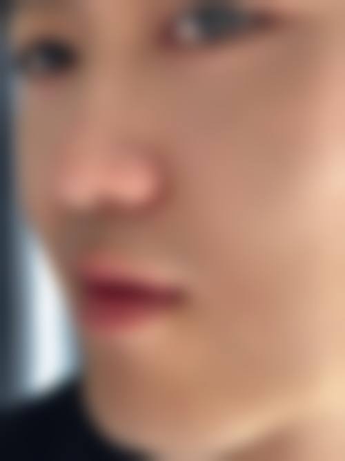 九、沈阳丽格整形医院真实的患者评价