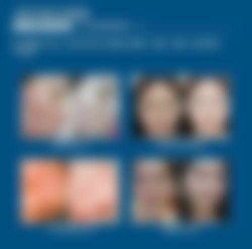 八、徐州鼓楼方妍医疗美容门诊部预约方式