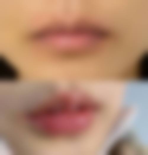 五、南充依美整形医疗美容医院价格表