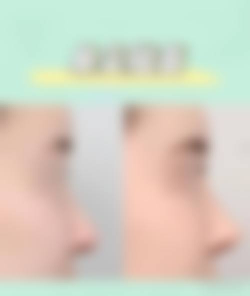 二、泰州泰勒美医疗美容医院怎么样？