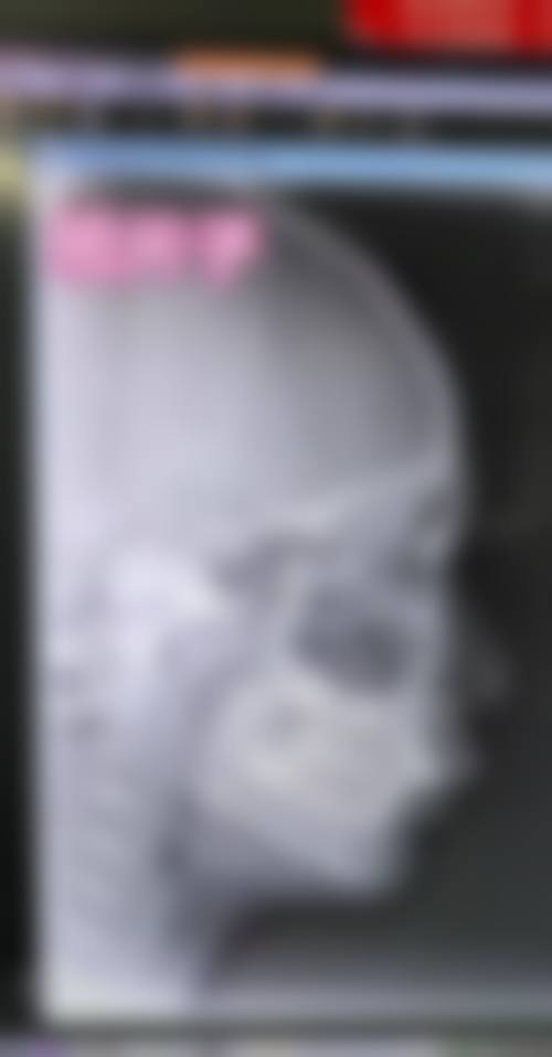 二、W Clinic 心斎橋怎么样？