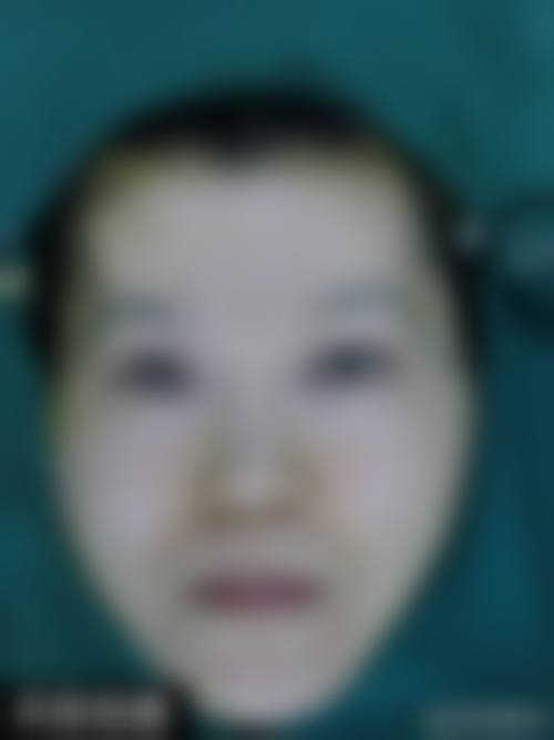 四、北京清心整形美容医院特色项目