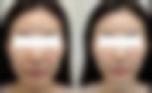 四、内蒙鄂尔多斯德康医院医美分院特色项目