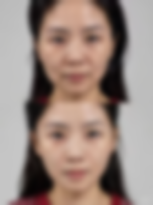 二、景德镇亚菲医疗美容怎么样？