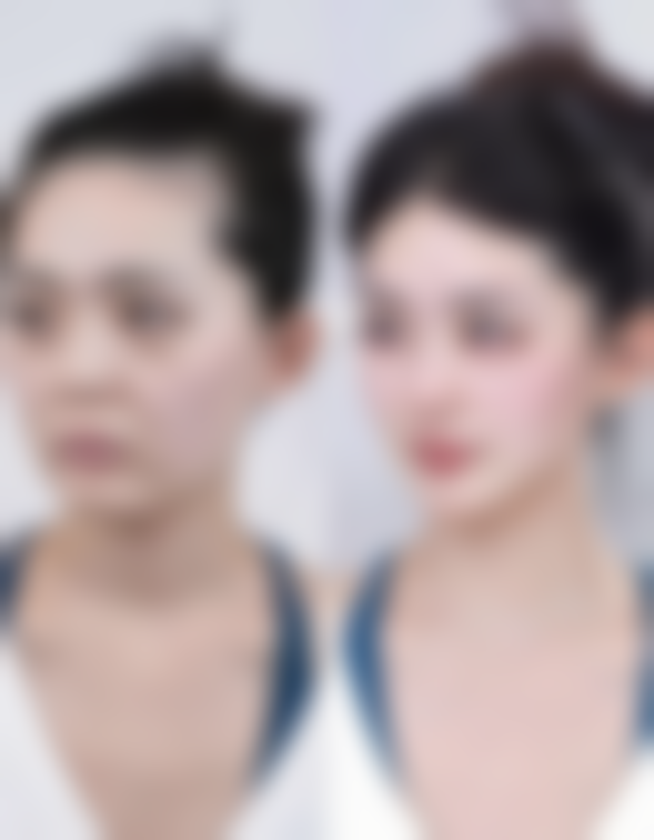 八、杭州美佳美医疗美容门诊部预约方式