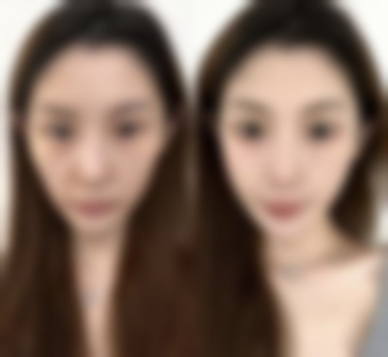 八、南充依美整形医疗美容医院真实的患者评价