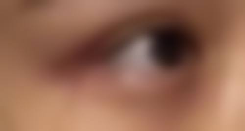 四、日常护理注意事项