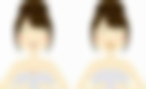 五、刚做完双眼皮手术眼睑外翻修复心态特别重要