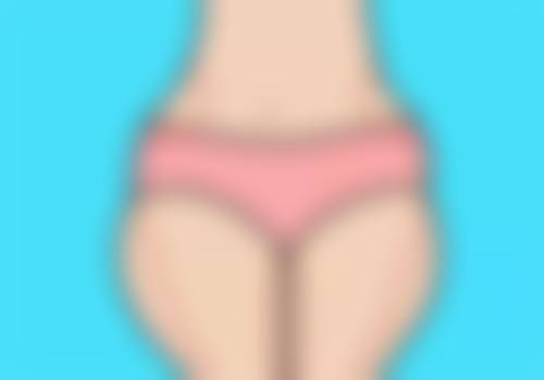 五、头发种植成效到底好不好之适用情况与技术选择