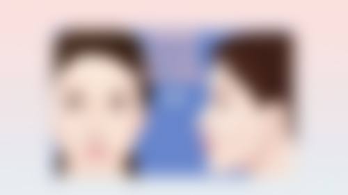 一、腿抽脂后疼痛缓解的大致时间