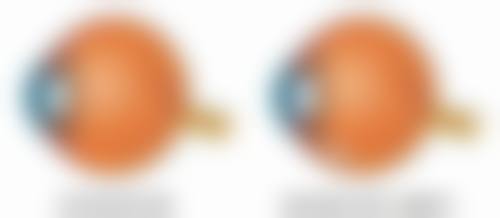 二、不同时期的疤痕处理方法