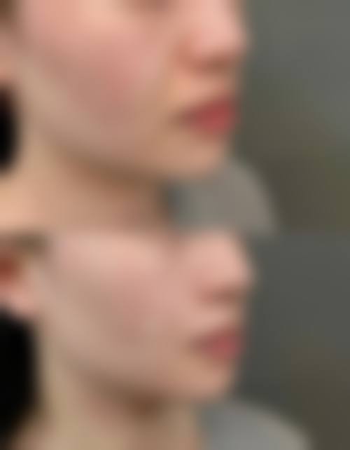 三、合阳县柠檬树整形医院诊疗项目有哪些？