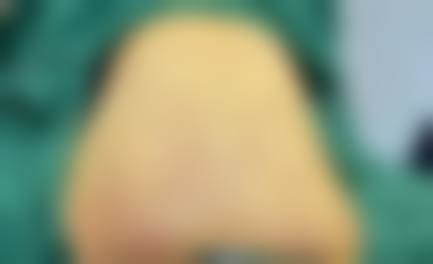 三、深圳江南医疗美容诊所诊疗项目有哪些?