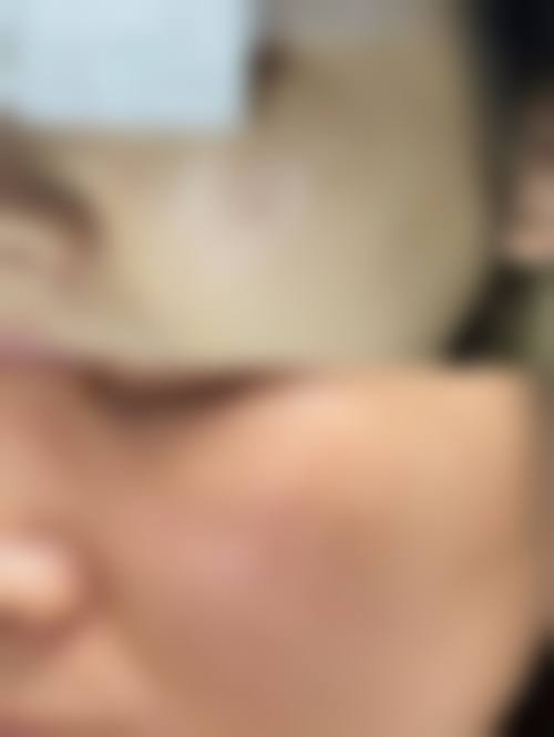 六、西安美赫拉医疗美容门诊部价格表