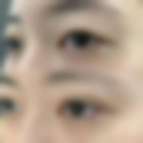 八、深圳瑞敏皮肤病医院真实的患者评价