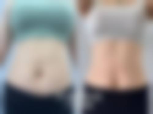 二、承德瀚美医疗整形美容诊所怎么样？