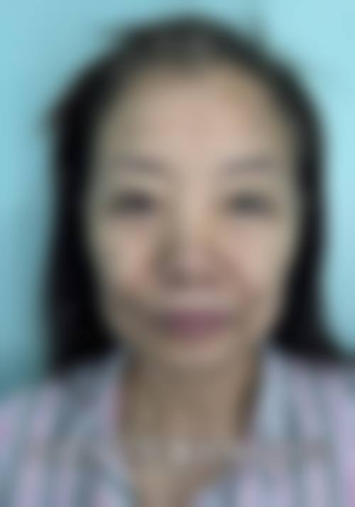 八、合阳县柠檬树整形医院预约方式