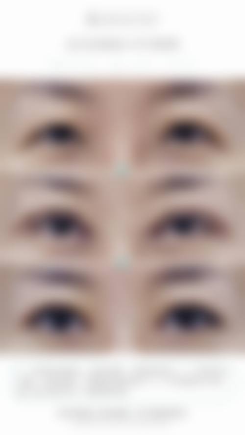 二、深圳瑞敏皮肤病医院怎么样？