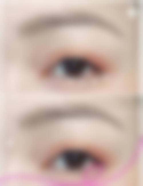 八、永康美原子觅星颜整形医院预约方式