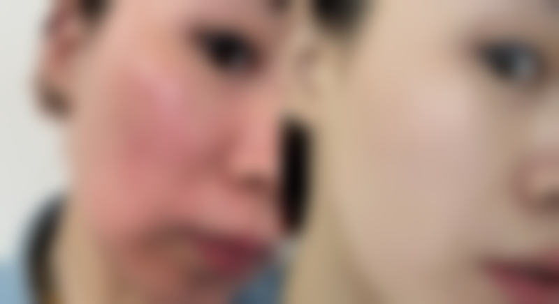 六、结尾：手术抽脂成效好不好，综合考量做选择