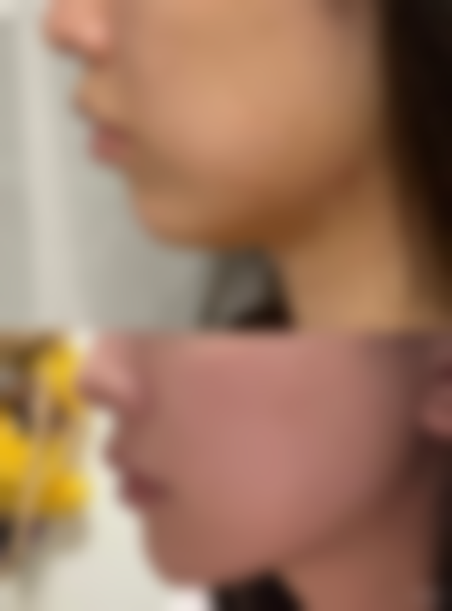 七、深圳法茉芮整形医院预约方式