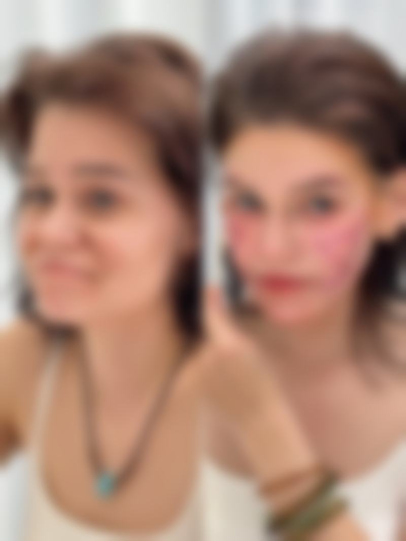 二、深圳法茉芮整形医院怎么样？