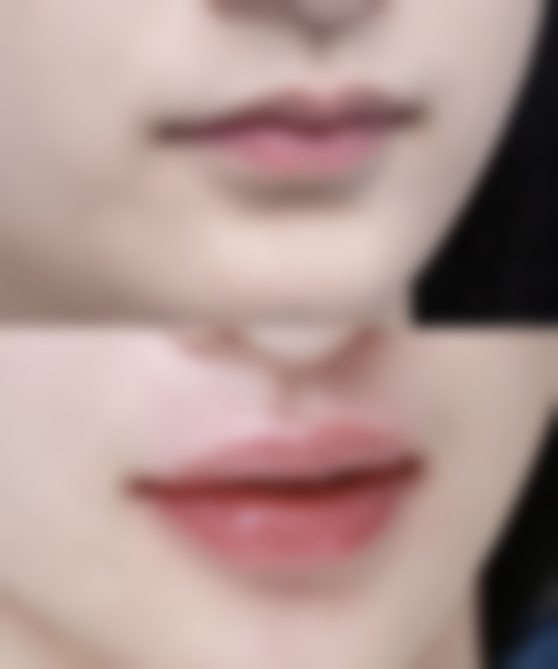 一、了解眼袋成因，为选择方法打基础