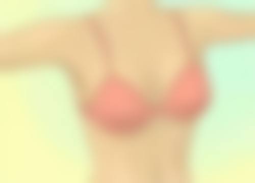 六、极射峰隆鼻的价格与选择