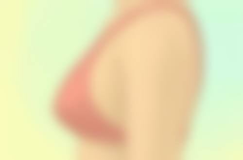 二、激光后不同阶段的疤痕护理