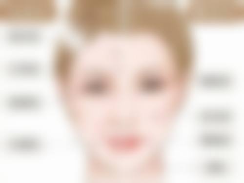 二、极射峰隆鼻的实例分析——以实际成效说话