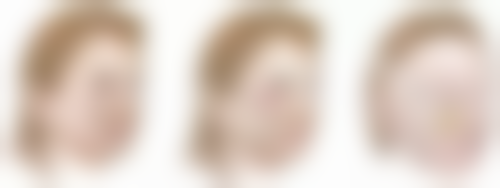 瘦脸针50单位够了吗？咬肌大小、药物品牌等多因素决定是否够用 