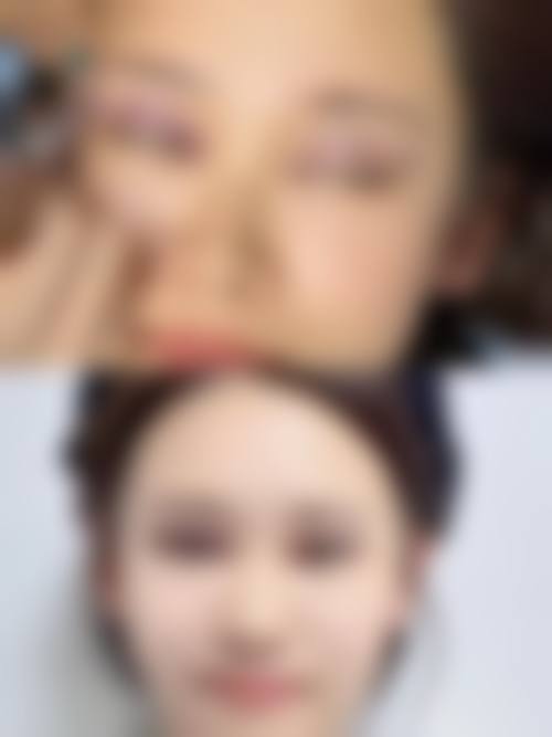 九、南通英莎医疗美容门诊部真实的患者评价