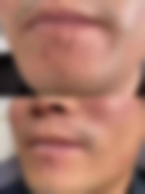 六、南通英莎医疗美容门诊部价格表