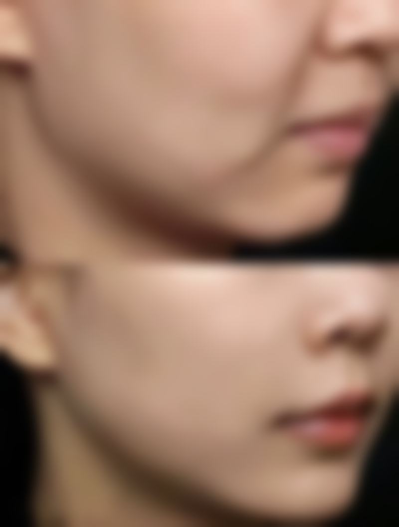 二、不同阶段的医美干预方案