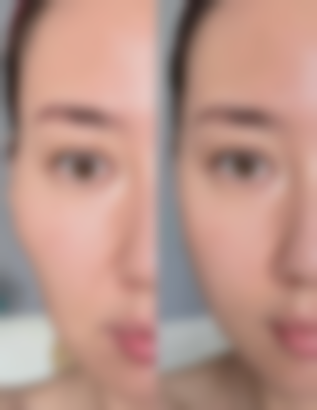 一、小时候疤痕修复的关键思路