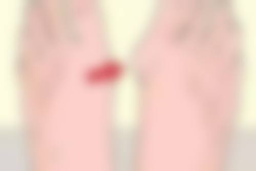 四、真相到底是什么——孟子义双眼皮是不是割的