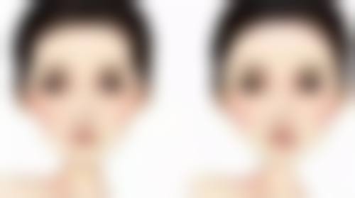 二、常见无痕双眼皮修复方案及适用情况