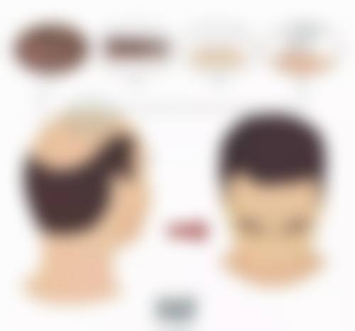 七、杭州悦可医疗美容诊所激光脱毛的客户评价和实例展示