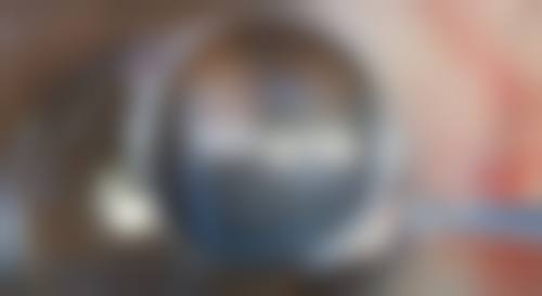 疤痕还是红色的还能修复吗