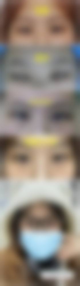 九、广州唯伊医疗美容门诊真实的患者评价