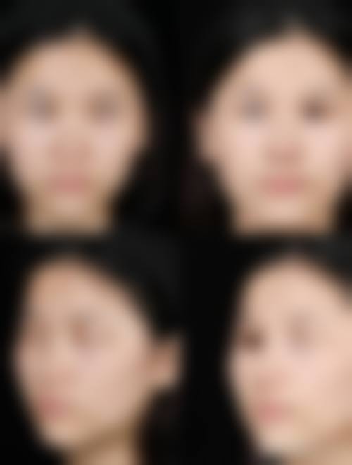 九、韩国slimyoung clinic医院真实的患者评价