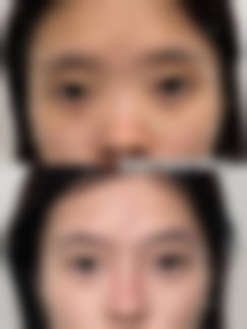 四、莱芜市人民医院整形烧伤科特色项目