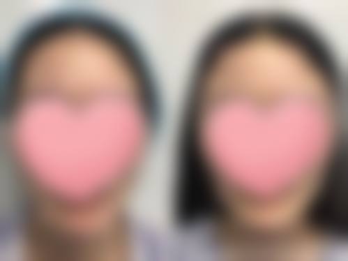 九、庄原美容外科诊所真实的患者评价